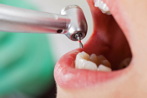 Best Pediatric Emergency Dentist in Idalou, TX